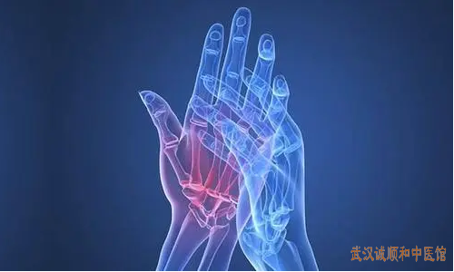 武汉中南路骨伤科名老中医董晓俊双手手指关节退行性病变医案一则