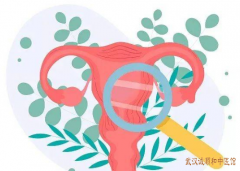 子宫内膜异位症的主要病机是什么？吃什么中药方子治疗效果好？