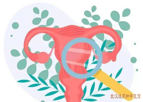子宫内膜异位症的主要病机是什么?吃什么中药方子治疗效果好?