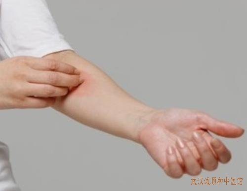 中医气功疗法是指什么临床上治疗心理疾病有效果吗?