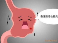 慢性萎缩性胃炎上腹部隐痛疲乏无力厌食消瘦用什么中药好？