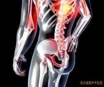 下腰痛是什么原因中医用什么方子可以治疗不明原因引发的腰痛?