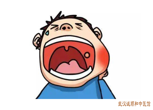 唇炎
