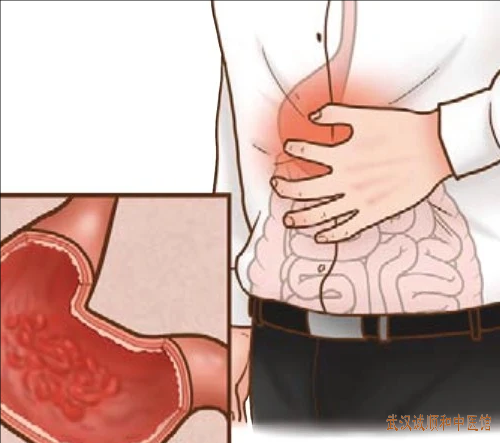 脾胃病