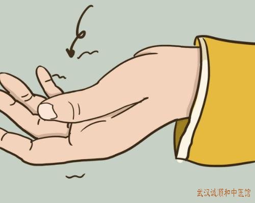 武汉中南路疼痛科专家：手臂肌腱炎左手臂疼痛麻木吃什么中药缓解？