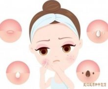 皮肤容易炎症红斑水疱瘙痒面部日光性皮炎中医有没有办法治疗?