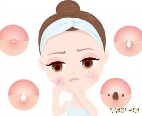 皮肤容易炎症红斑水疱瘙痒面部日光性皮炎中医有没有办法治疗?