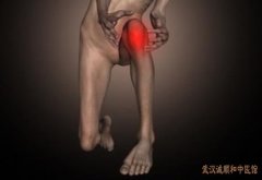 中医治疗与护理对骨折术后康复效果如何?