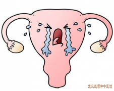 多囊卵巢综合征月经不调受孕困难中医如何辨证调理有效果？