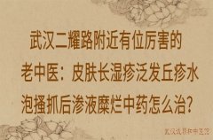 武汉二耀路附近有位厉害的老中医：皮肤长湿疹泛发丘疹水泡搔抓后渗液糜