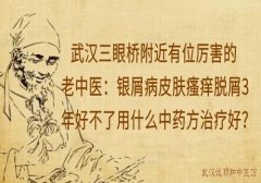 武汉三眼桥附近有位厉害的老中医：银屑病皮肤瘙痒脱屑3年好不了用什么中