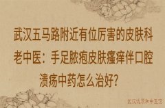 武汉五马路附近有位厉害的皮肤科老中医：手足脓疱皮肤瘙痒伴口腔溃疡中