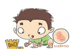 神经性皮炎皮肤瘙痒难忍中医辨证分型吃什么中药方子治疗有效果？