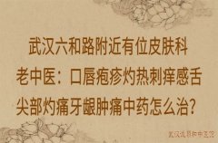 武汉六和路附近有位皮肤科老中医：口唇疱疹灼热刺痒感舌尖部灼痛牙龈肿