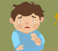 腹型过敏性紫癜小腹绞痛、腹泻伴呕吐日常注意些什么能有效缓解？