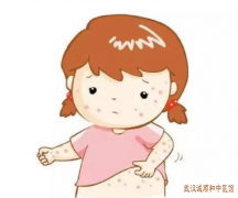 从中医的角度来看过敏性紫癜的发病机制及中医的主要治疗方法有哪些？