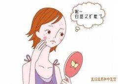 面部出现白癜风如何治疗能有效控制白斑扩散？有哪些好的治疗方法？