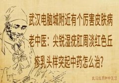 武汉电脑城附近有个厉害皮肤病老中医：尖锐湿疣肛周淡红色丘疹乳头样突