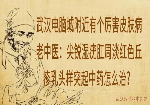 武汉电脑城附近有个厉害皮肤病老中医：尖锐湿疣肛周淡红色丘疹乳头样突起中药怎么治？