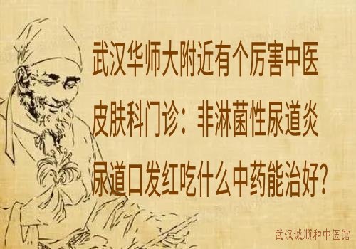 武汉华师大附近有个厉害中医皮肤科门诊：非淋菌性尿道炎尿道口发红吃什么中药能治好？