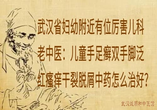 武汉省妇幼附近有位厉害儿科老中医：儿童手足癣双手脚泛红瘙痒干裂脱屑中药怎么治好？