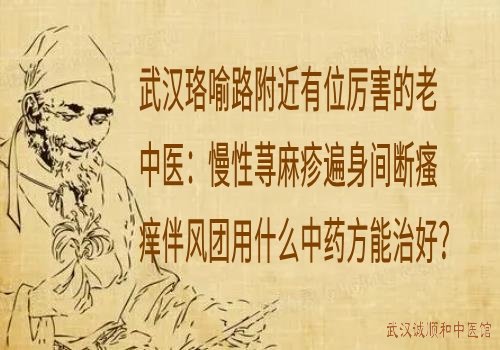 武汉珞喻路附近有位厉害的老中医：慢性荨麻疹遍身间断瘙痒伴风团用什么中药方能治好？