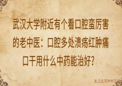 武汉大学附近有个看口腔蛮厉害的老中医：口腔多处溃疡红肿痛口干用什么