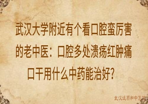 武汉大学附近有个看口腔蛮厉害的老中医：口腔多处溃疡红肿痛口干用什么中药能治好？