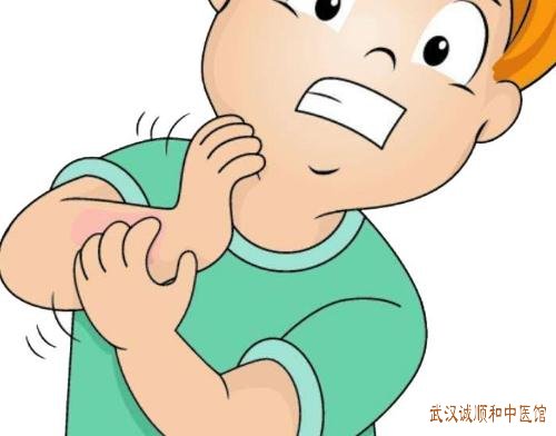 武汉民间厉害的皮肤科老中医专家：玫瑰糠疹身上块状红斑很难受怎么治好？