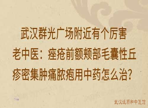 武汉群光广场附近有个厉害老中医：痤疮前额颊部毛囊性丘疹密集肿痛脓疱用中药怎么治？