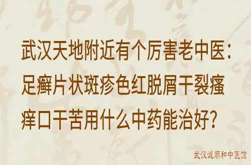 武汉天地附近有个厉害老中医：足癣片状斑疹色红脱屑干裂瘙痒口干苦用什么中药能治好？