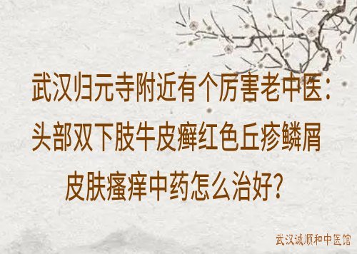 武汉归元寺附近有个厉害老中医：头部双下肢牛皮癣红色丘疹鳞屑皮肤瘙痒中药怎么治好？