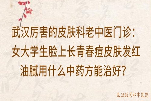 武汉厉害的皮肤科老中医门诊：女大学生脸上长青春痘皮肤发红油腻用什么中药方能治好？