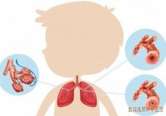 武汉武昌擅长治疗儿科呼吸道疾病的中医门诊：小儿发热持续性咳嗽支原体