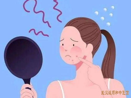 武汉珞狮南路附近看皮肤病有名的老中医:中青年脸上长痤疮中医怎么辨证治疗有效?