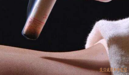 冬至时节养生锦囊：中医教你“藏阳”“补寒”，平安过冬少生病！