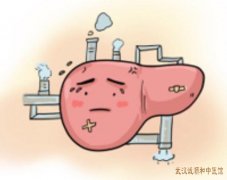 武汉中医治肝病专家哪个好？老年人肝硬化腹水出现腹部胀满伴纳差中医怎