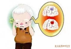 武汉看中风偏瘫专家医生：老人半身不遂患侧肢体僵硬拘挛伴头痛眩晕中医