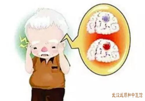 武汉看中风偏瘫专家医生:老人半身不遂患侧肢体僵硬拘挛伴头痛眩晕中医怎么调理?