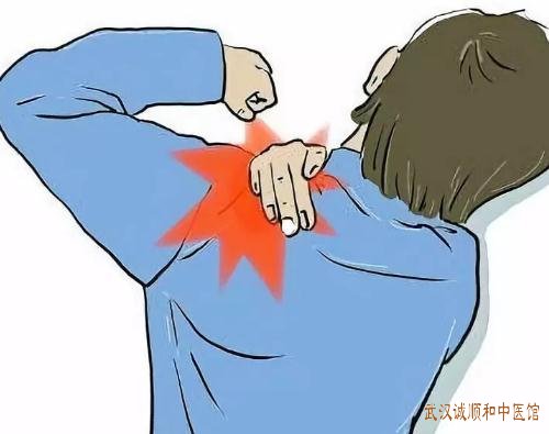 武汉治肩周炎的中医哪家好?35岁中年男性肩部刺痛固定活动受限伴随着疼痛加重怎么调?