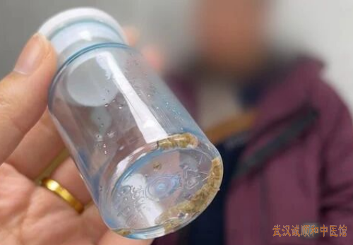 武汉有位“扫地僧”,简单方子治“怪病”!结石、结节、痛风、肿瘤……祸根竟然是它!