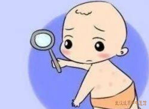 武汉湿疹皮肤科专家门诊在哪里？婴儿反复起红疹瘙痒难耐伴有食欲不振中医怎么辨证治疗？