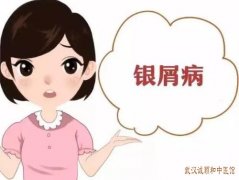 武汉中医看小儿银屑病的医院有哪些?小儿得了银屑病1年皮肤干裂粗糙伴便